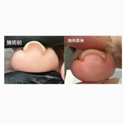 爪のお悩みありませんか？