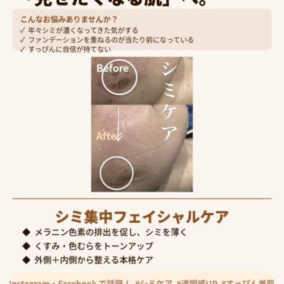 毛穴・くすみ・たるみに。