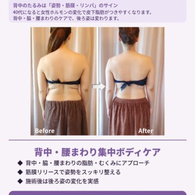 自分では難しいケアはプロに。