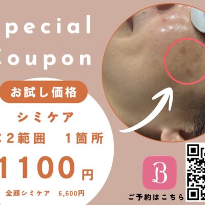 シミ・くすみが気になる方へ。