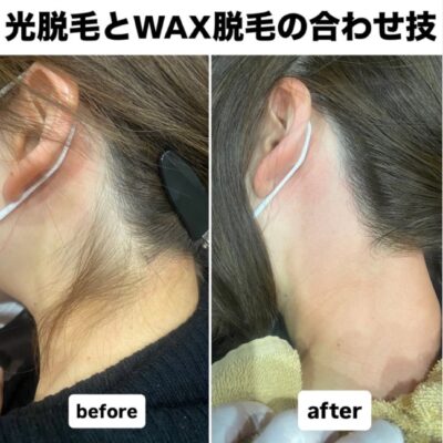 清潔感アップ↗️↗️